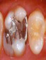 �C�����[